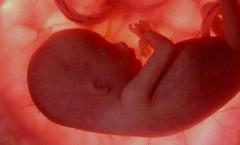 Tumačenje snova embrion je mrtav.  Šta predstavlja embrion?  Tumačenje snova Yurija Longa